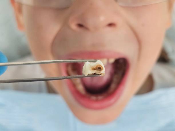 Best Holiday Emergency Dentist in Napervle, IL